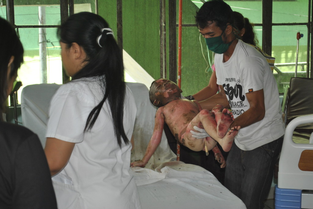 John Mark Ocenar,6, was the last to succumb after his mother and five siblings died when their tent-house  at Barangay 88(Costa Brava) in San Jose District, Tacloban, was engulfed with fire last May 28 while they were sleeping.(LITO A. BAGUNAS)